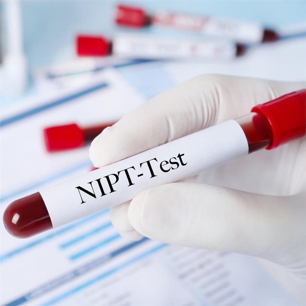 NIPT testi için kan örneği tüpü